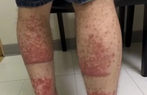 Here Are Some Problems That Can Happen If You Don’t Get Proper Sleep