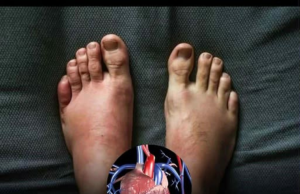 Warning signs of a heart attack?