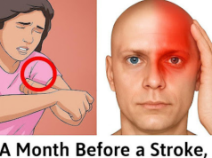 A Month Before a Stroke, Your Body Warns You: 10 Signs Not to Ignore