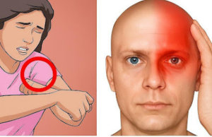 A Month Before a Stroke, Your Body Warns You: 10 Signs Not to Ignore