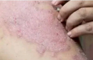 These Are the Consequences of Sleeping With ……