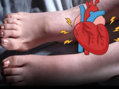 6 Foot Signals That Hint at Heart Trouble Early