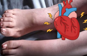 6 Foot Signals That Hint at Heart Trouble Early