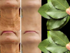 Bay Leaf Is 100,000 Times Stronger Than Botox? | Natural Wrinkle Eraser Even at Age 70!