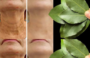 Bay Leaf Is 100,000 Times Stronger Than Botox? | Natural Wrinkle Eraser Even at Age 70!