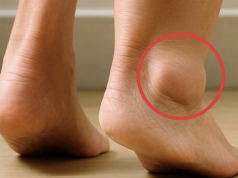 Swollen Legs and Feet: Gentle Insights & Natural Ways to Find Relief