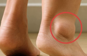 Swollen Legs and Feet: Gentle Insights & Natural Ways to Find Relief