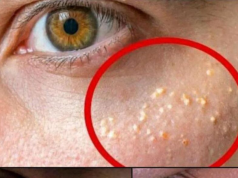 Tiny White Bumps on Your Face? Understanding Milia—and Caring for Your Skin with Kindness