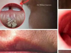 Hidden Dangers in Your Mouth: Early Signs of Oral Cancer
