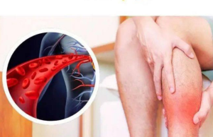 One Vitamin That Opens Blood Vessels and Improves Circulation