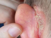 I noticed a strange patch of skin on my son’s ear this morning. His doctor appointment is still a week away — what should I do in the meantime?