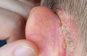 I noticed a strange patch of skin on my son’s ear this morning. His doctor appointment is still a week away — what should I do in the meantime?