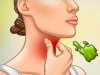 The Real Causes of Constant Phlegm and Mucus in Throat and How to Get Rid of It
