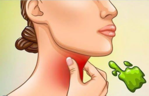 The Real Causes of Constant Phlegm and Mucus in Throat and How to Get Rid of It