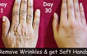 How to Soften Wrinkles and Restore Youthful Radiance to Your Hands—Naturally