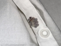 Tiny Eggs on Your Sheets? Here’s What You’re Actually Dealing With