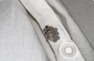 Tiny Eggs on Your Sheets? Here’s What You’re Actually Dealing With
