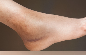 When Your Legs Feel Heavy, Cold, or Restless—Here’s What’s Really Happening (and How to Gently Restore Flow)