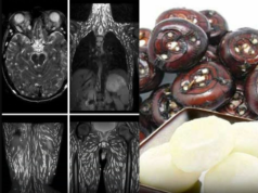 ONE BITE IS ALL IT TAKES: The Silent Parasite Crisis Hiding in Your Everyday Meals