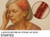 A Month Before My Stroke, My Body Gave Me Four Clear Warnings—Here’s What I Missed