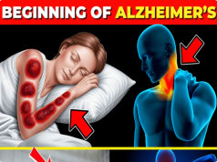 7 Early Warning Signs of Alzheimer’s Disease You Should Never Ignore