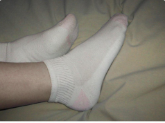 Why seniors should wear socks even at home