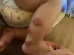 ALERT: These are the signs that it is cre…See more