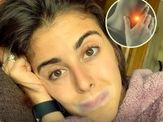 My mouth is dry at night and pasty when I wake up: what are the causes (and what can be done)?